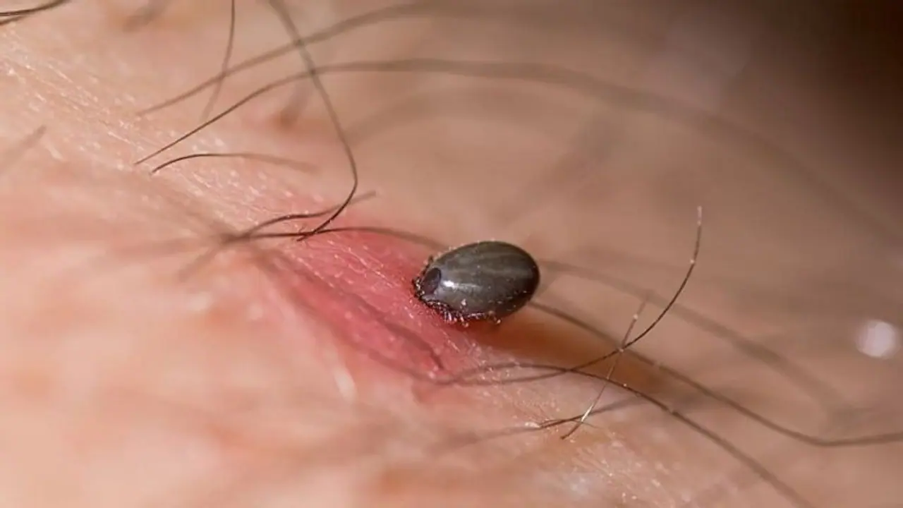 ಹುಳ ಕಚ್ಚಿದ್ದಕ್ಕೆ ಮನೆ ಮದ್ದು ಹುಳ ಕಚ್ಚಿದ್ದಕ್ಕೆ ಮನೆ ಮದ್ದು