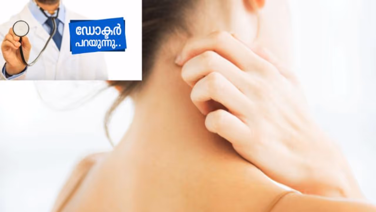സോറിയാസിസ് പകരുമോ? അറിയേണ്ടതും മനസ്സിലാക്കേണ്ടതും...