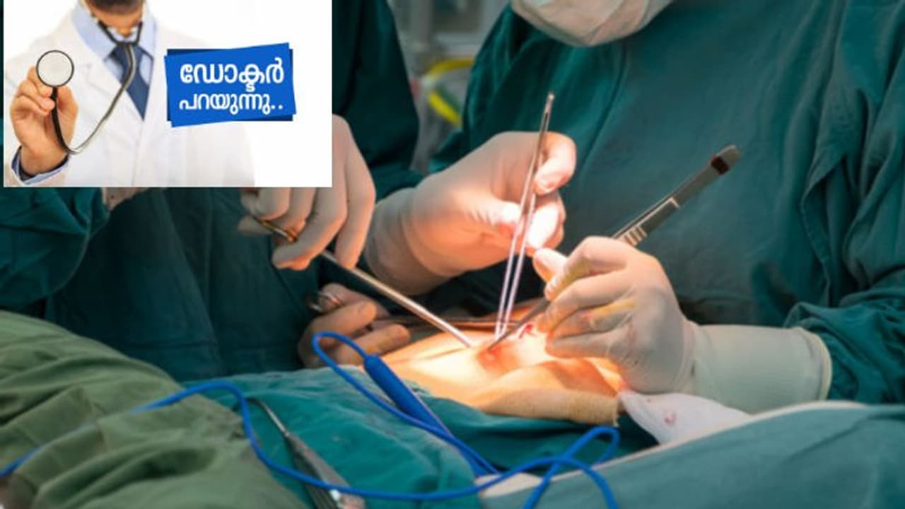 എന്താണ് 'കീ ഹോള്' ശസ്ത്രക്രിയ; ഡോക്ടര് പറയുന്നു... എന്താണ് 'കീ ഹോള്' ശസ്ത്രക്രിയ; ഡോക്ടര് പറയുന്നു...