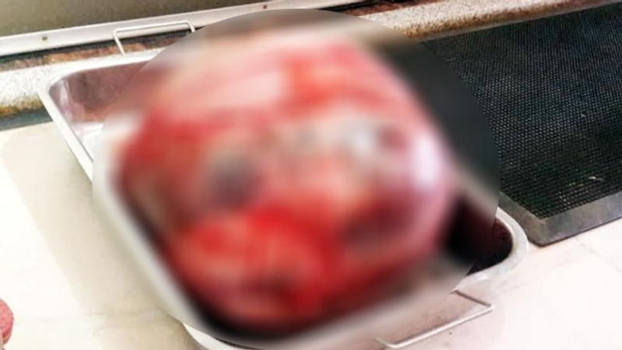 ಮಹಿಳೆಯ ಹೊಟ್ಟೆಯಲ್ಲಿ 12 ಕೆಜಿ ಗಡ್ಡೆ! ಮಹಿಳೆಯ ಹೊಟ್ಟೆಯಲ್ಲಿ 12 ಕೆಜಿ ಗಡ್ಡೆ!