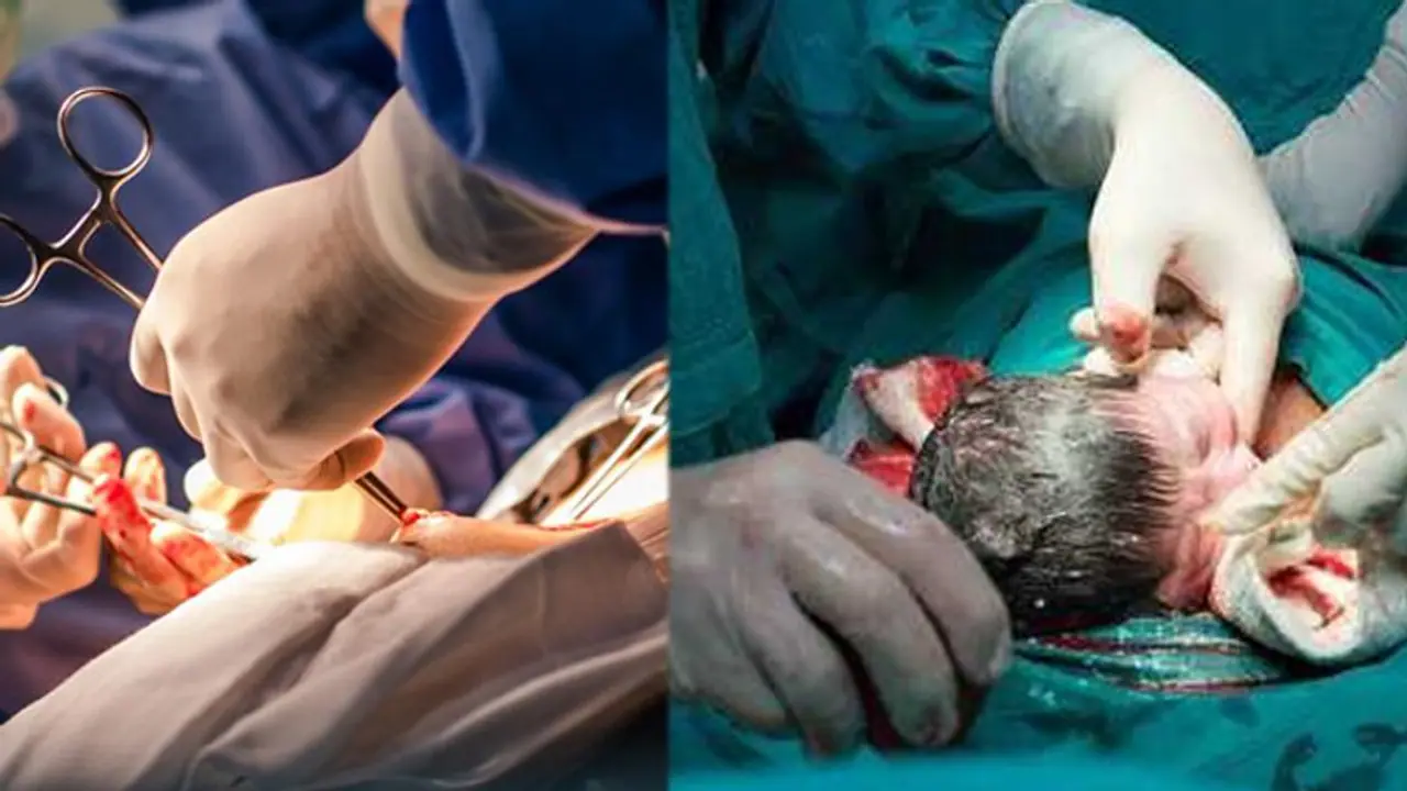 Cesarean baby: சிசேரியன் மூலம் குழந்தை பெற்றவர்களா ..? உங்களுக்கு இந்த 5 விஷயங்களில் அதிக கவனம் தேவை!
