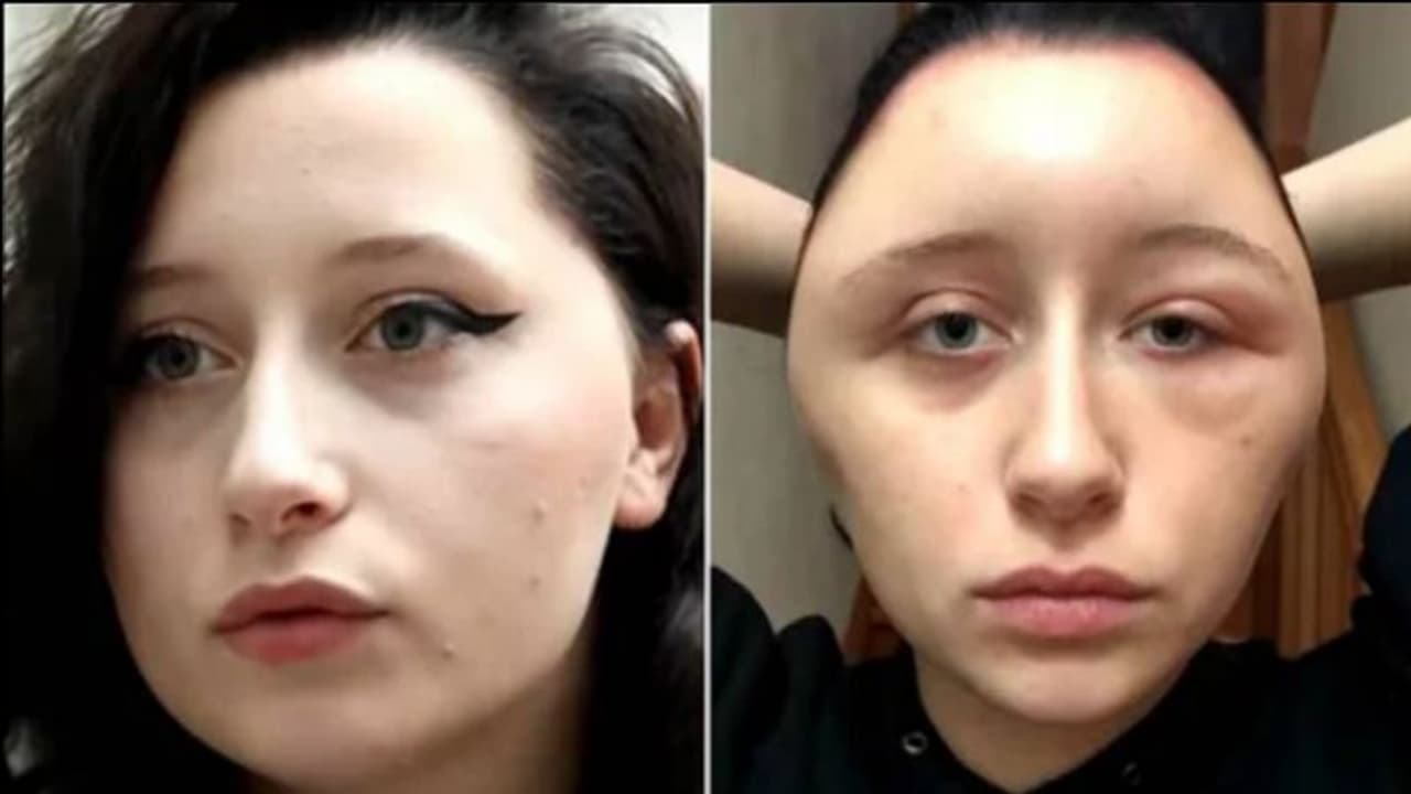 ഒന്ന് ഹെയര് ഡൈ ചെയ്തതാണ്; ഇതായി അവസ്ഥ ഒന്ന് ഹെയര് ഡൈ ചെയ്തതാണ്; ഇതായി അവസ്ഥ