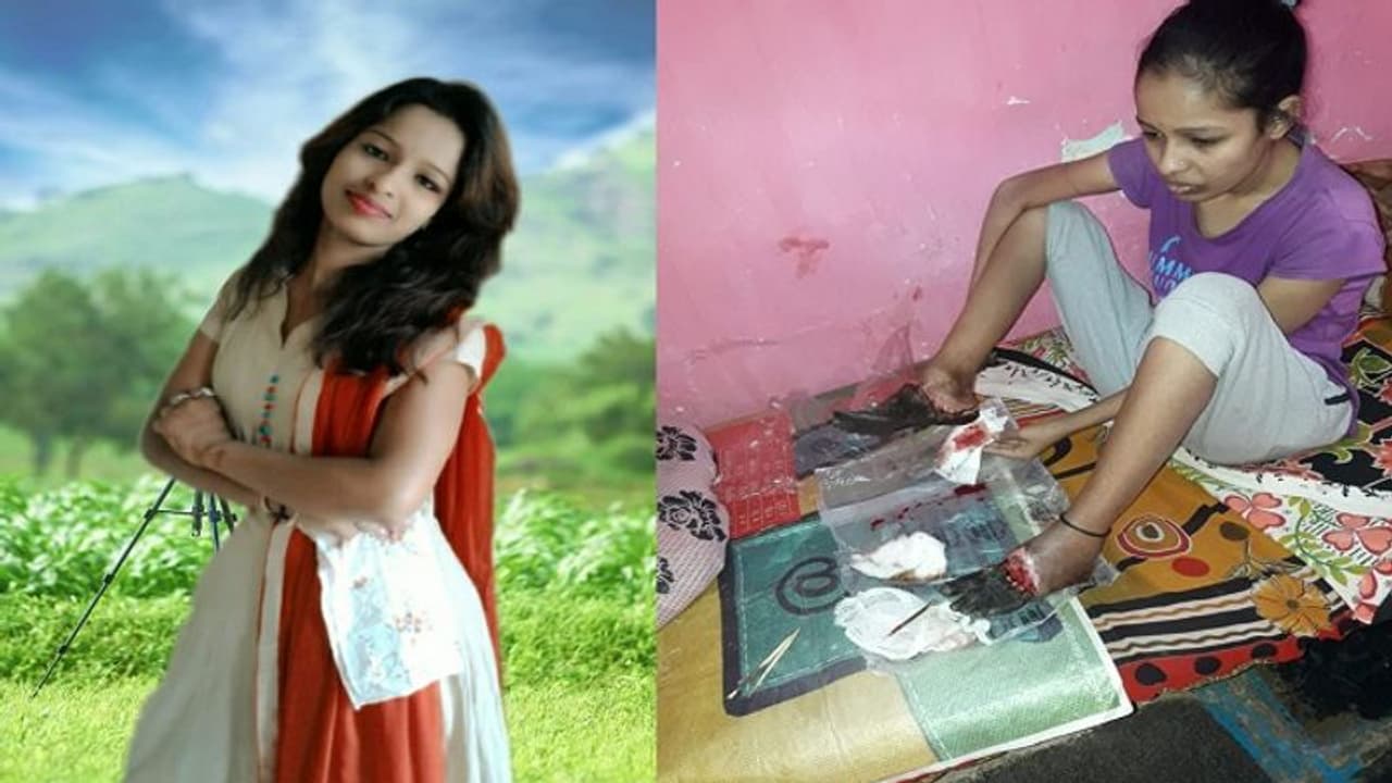 ವೈದ್ಯರ ಎಡವಟ್ಟಿಗೆ ನರಕವಾದ ಹುಬ್ಬಳ್ಳಿ ಯುವತಿ ಬಾಳು.. ಹೇಗಿದ್ದವಳು..ಹೇಗಾದಳು! ವೈದ್ಯರ ಎಡವಟ್ಟಿಗೆ ನರಕವಾದ ಹುಬ್ಬಳ್ಳಿ ಯುವತಿ ಬಾಳು.. ಹೇಗಿದ್ದವಳು..ಹೇಗಾದಳು!