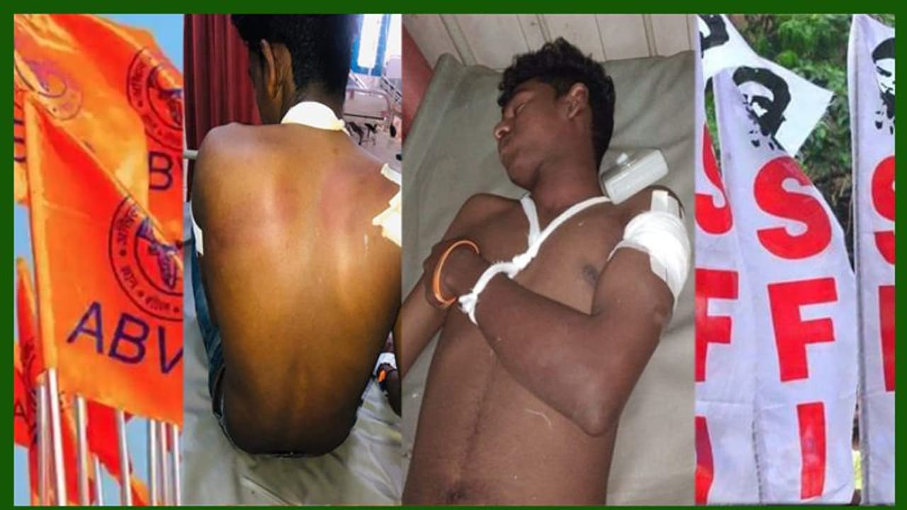 കാലടിയില് എസ്എഫ്ഐയ്ക്കാരെ കുടുക്കാന് ശരീരത്തില് ആഴത്തില് മുറിവുണ്ടാക്കിയ എബിവിപിക്കാരന് അന്വേഷണത്തില് കുടുങ്ങി കാലടിയില് എസ്എഫ്ഐയ്ക്കാരെ കുടുക്കാന് ശരീരത്തില് ആഴത്തില് മുറിവുണ്ടാക്കിയ എബിവിപിക്കാരന് അന്വേഷണത്തില് കുടുങ്ങി