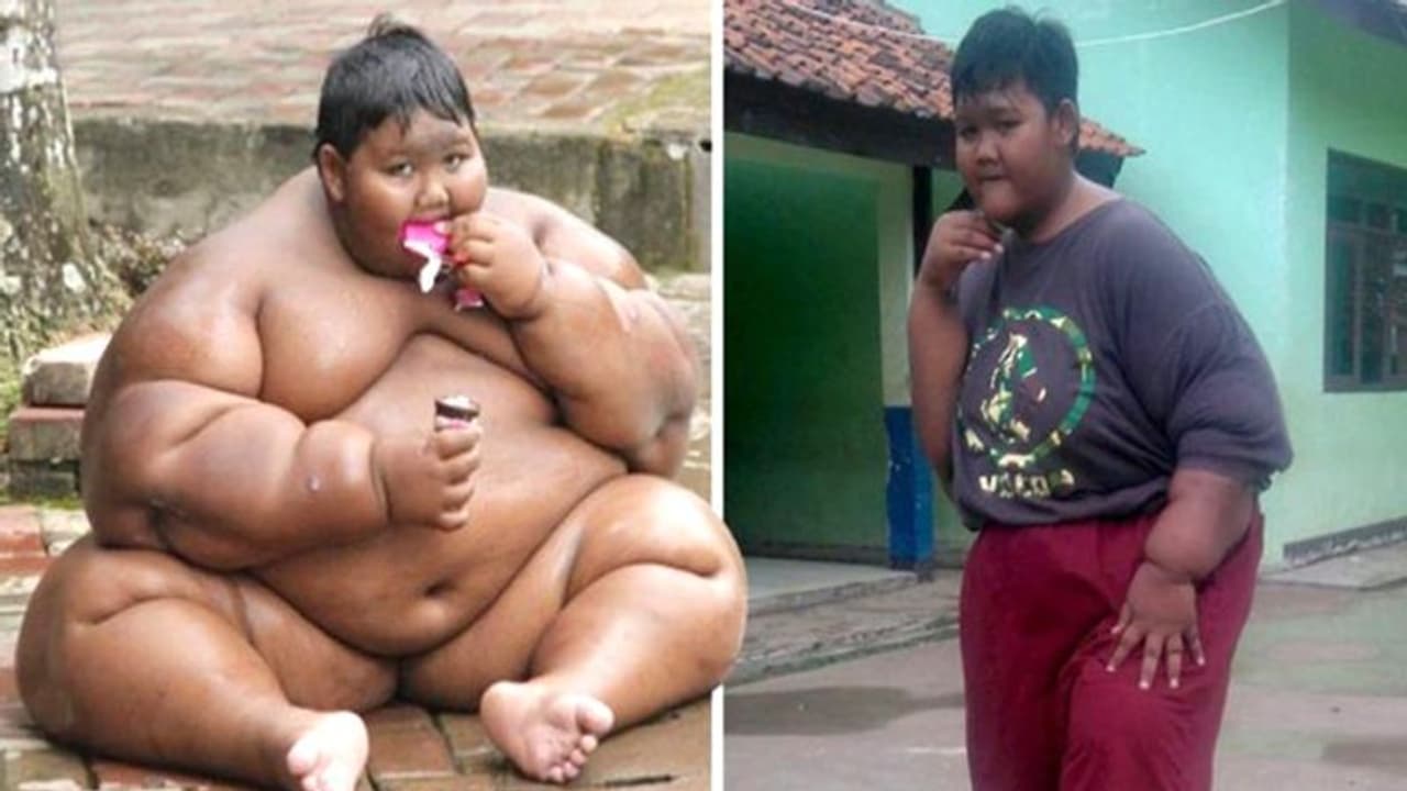 ലോകത്തിലെ ഏറ്റവും ഭാരം കൂടിയ ബാലൻ; നേരത്തെ 190 കിലോ, ഇപ്പോള് 96! ലോകത്തിലെ ഏറ്റവും ഭാരം കൂടിയ ബാലൻ; നേരത്തെ 190 കിലോ, ഇപ്പോള് 96!