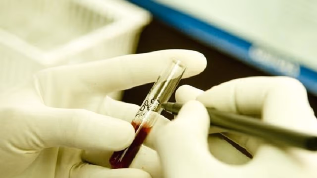 കുവൈത്തില് 42 സൈനിക ഉദ്യോഗസ്ഥര്ക്ക് എയിഡ്സ് രോഗബാധ സ്ഥിരീകരിച്ചു കുവൈത്തില് 42 സൈനിക ഉദ്യോഗസ്ഥര്ക്ക് എയിഡ്സ് രോഗബാധ സ്ഥിരീകരിച്ചു