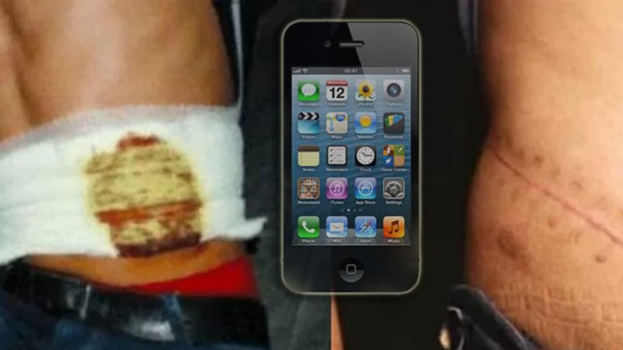 iPhone ಶೋಕಿಗಾಗಿ ಕಿಡ್ನಿಯನ್ನೇ ಮಾರಿದ ಬಾಲಕ: ಜೀವಕ್ಕೆ ಕುತ್ತು! iPhone ಶೋಕಿಗಾಗಿ ಕಿಡ್ನಿಯನ್ನೇ ಮಾರಿದ ಬಾಲಕ: ಜೀವಕ್ಕೆ ಕುತ್ತು!