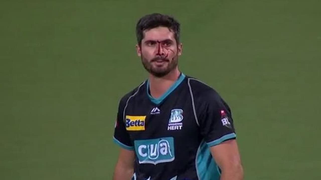 ತಪ್ಪಿದ ಕ್ಯಾಚ್..ಮುಖವೆಲ್ಲ ರಕ್ತ.. ಆಸ್ಟ್ರೇಲಿಯಾ ಆಲ್ರೌಂಡರ್ಗೆ ಏನಾಯ್ತು? ತಪ್ಪಿದ ಕ್ಯಾಚ್..ಮುಖವೆಲ್ಲ ರಕ್ತ.. ಆಸ್ಟ್ರೇಲಿಯಾ ಆಲ್ರೌಂಡರ್ಗೆ ಏನಾಯ್ತು?