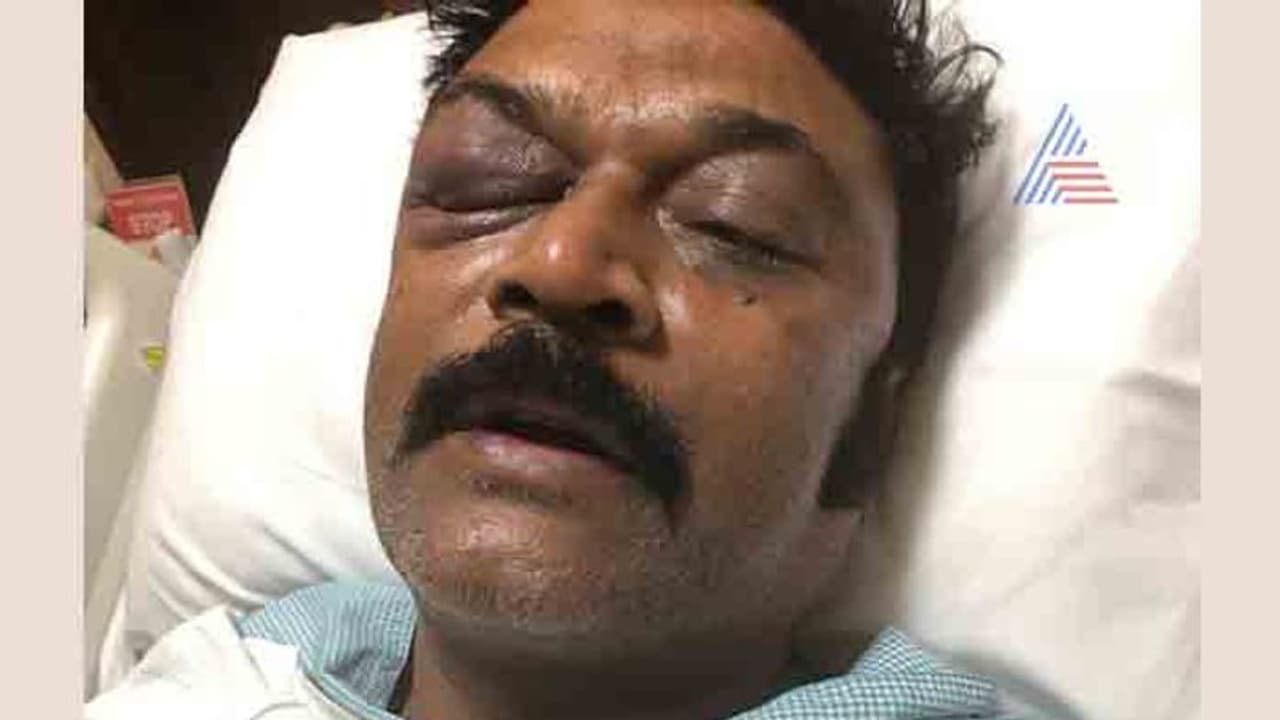 ಏಟು ತಿಂದ ಆನಂದ್ ಸಿಂಗ್ ಹೇಗಿದ್ದಾರೆ? ಫೋಟೋ ಹಿಂದಿನ ಸತ್ಯ! ಏಟು ತಿಂದ ಆನಂದ್ ಸಿಂಗ್ ಹೇಗಿದ್ದಾರೆ? ಫೋಟೋ ಹಿಂದಿನ ಸತ್ಯ!