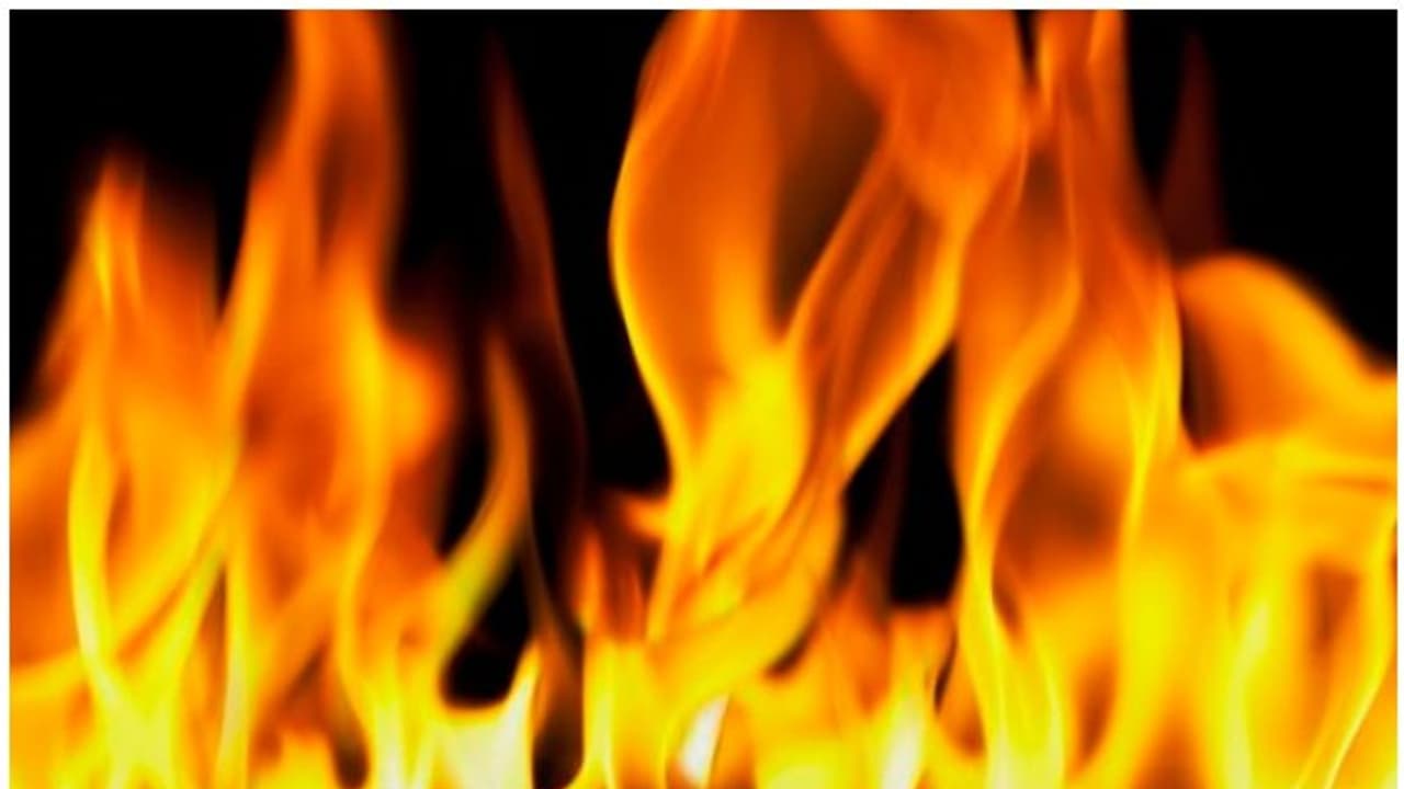 Andhra Pradesh native sets 12 year old girl on fire; victim critical