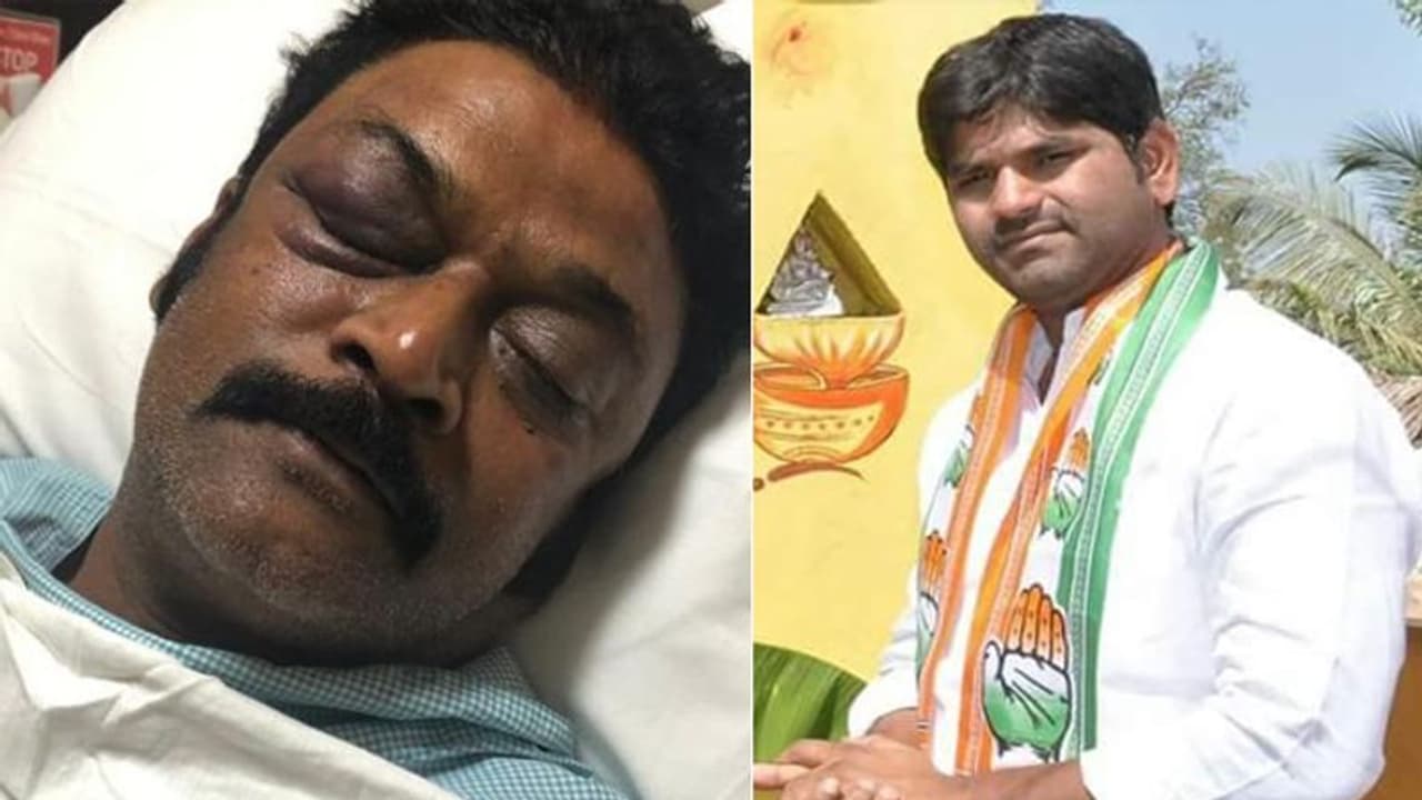 ಮೊದಲು ಹೊಡೆದದ್ದೇ ಆನಂದ್ ಸಿಂಗ್!: ಹಲ್ಲೆ ಪ್ರಕರಣಕ್ಕೆ ಹೊಸ ಟ್ವಿಸ್ಟ್