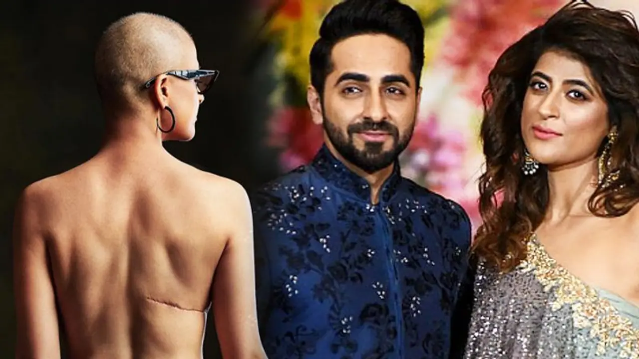 Ayushmann Khurrana’s wife Tahira Kashyap shows off her scars in powerful pic on World Cancer Day. See pic