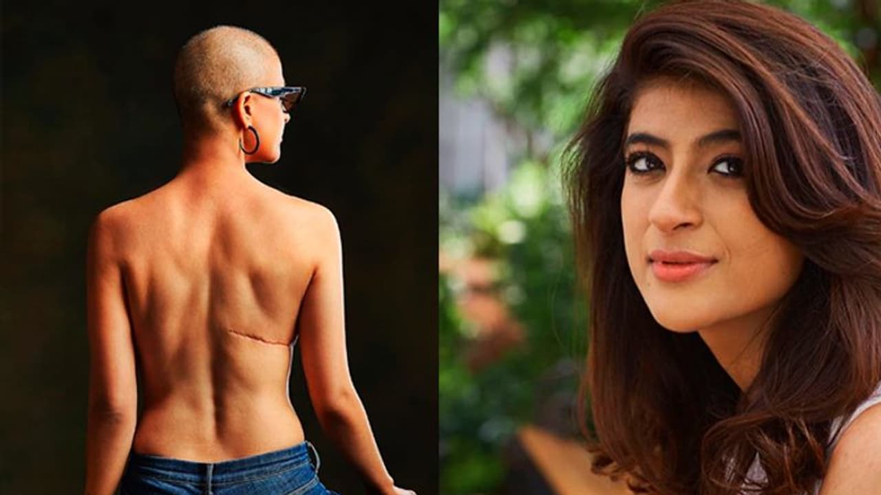 ഇത് അർബുദത്തിന്റെ മുറിപ്പാട്; ഇൻസ്റ്റഗ്രാമിൽ വൈറലായി താഹിറാ കാശ്യപിന്റെ ഫോട്ടോ ഇത് അർബുദത്തിന്റെ മുറിപ്പാട്; ഇൻസ്റ്റഗ്രാമിൽ വൈറലായി താഹിറാ കാശ്യപിന്റെ ഫോട്ടോ