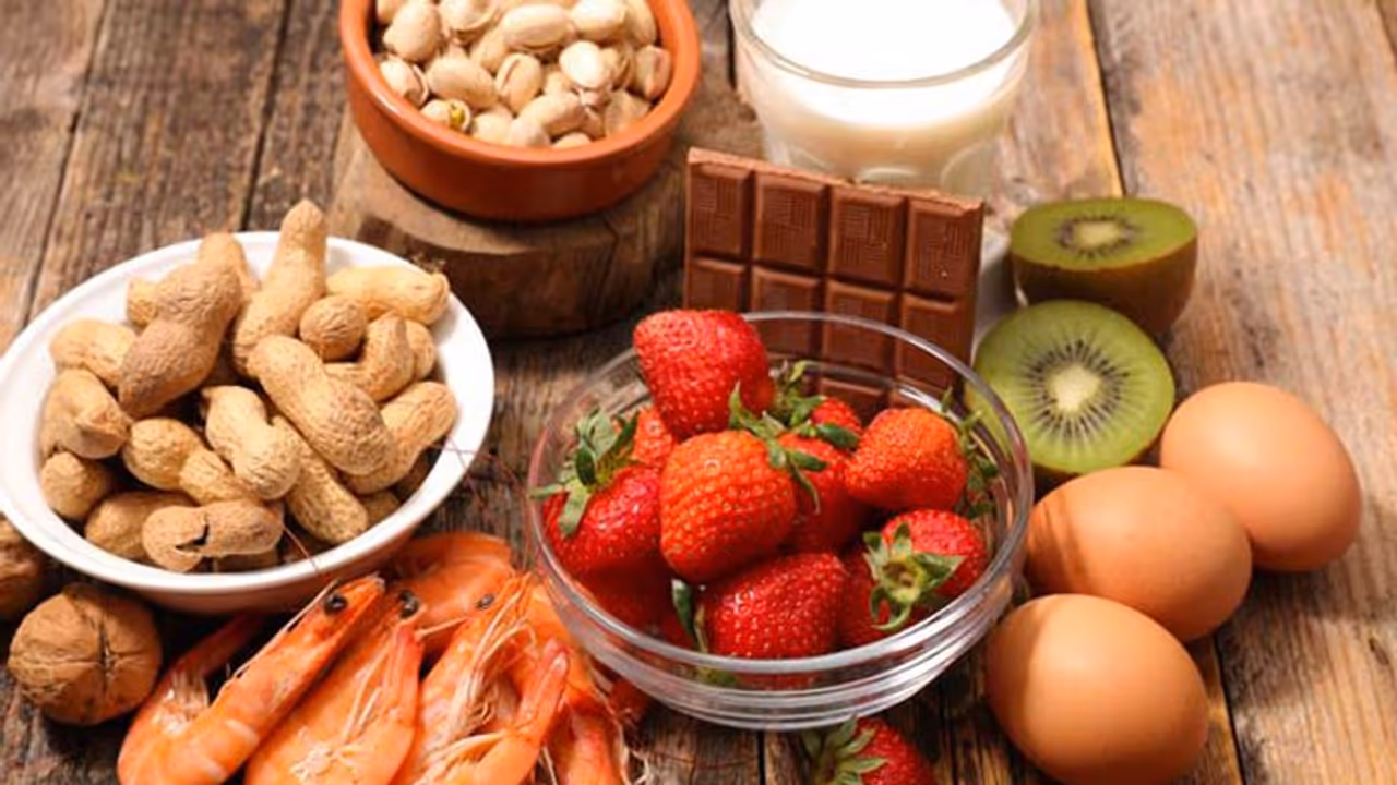 അലർജി ഉണ്ടാക്കുന്ന 5 തരം ഭക്ഷണങ്ങൾ അലർജി ഉണ്ടാക്കുന്ന 5 തരം ഭക്ഷണങ്ങൾ