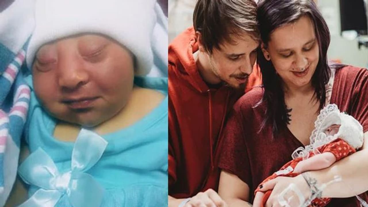 ഈ കുഞ്ഞ് ജനിച്ച് 30 മിനിറ്റ് കൂടുതൽ ജീവിച്ചിരിക്കില്ല; ആയുസ്സില്ലെന്ന് വിധിയെഴുതിയ കുഞ്ഞിന് ജന്മം നൽകി, അവയവങ്ങൾ ദാനം ചെയ്തു ഈ കുഞ്ഞ് ജനിച്ച് 30 മിനിറ്റ് കൂടുതൽ ജീവിച്ചിരിക്കില്ല; ആയുസ്സില്ലെന്ന് വിധിയെഴുതിയ കുഞ്ഞിന് ജന്മം നൽകി, അവയവങ്ങൾ ദാനം ചെയ്തു