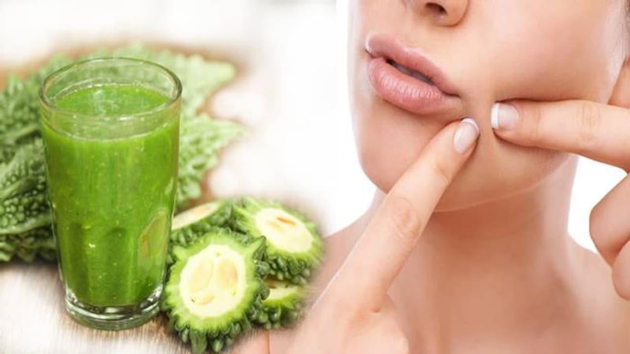 ಕಹಿ ಹಾಗಲ ಮೊಡವೆಗೆ ಮದ್ದು...! ಕಹಿ ಹಾಗಲ ಮೊಡವೆಗೆ ಮದ್ದು...!