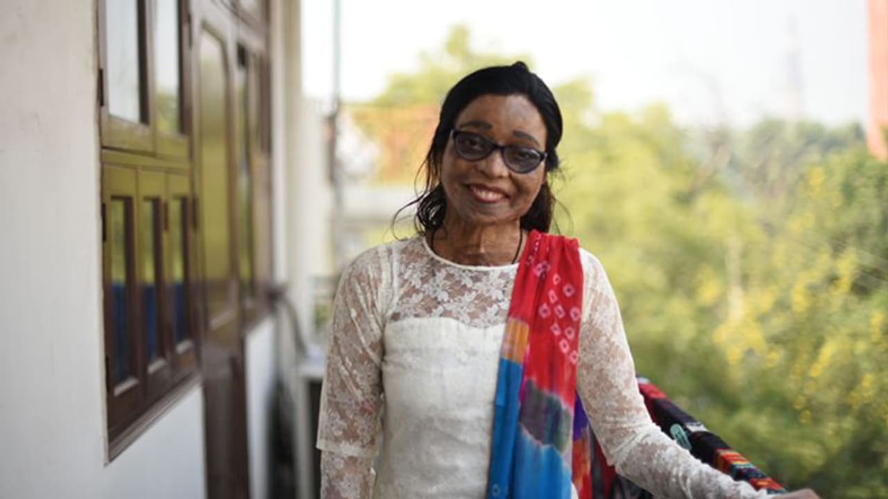 'ഭര്‍ത്താവ് എന്‍റെ മുഖത്ത് ആസിഡ് ഒഴിച്ചു, കൊല്ലാന്‍ ശ്രമിച്ചു'