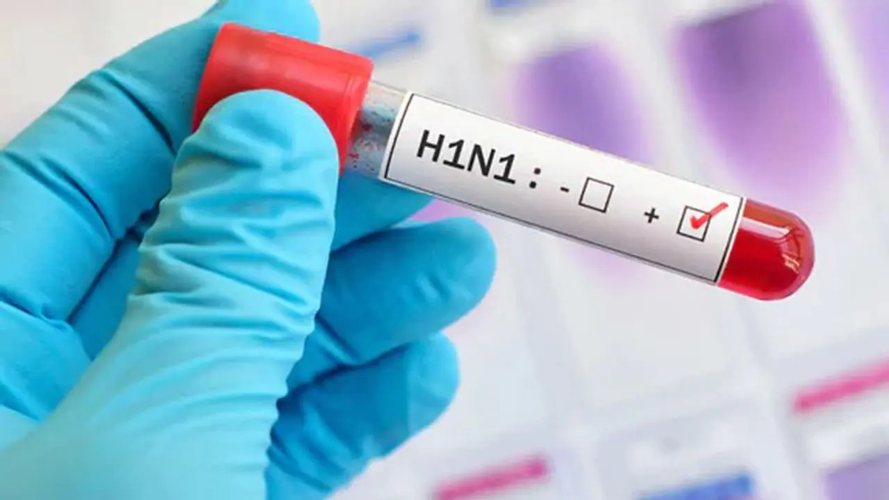 ರಾಜ್ಯಾದ್ಯಂತ ಹಂದಿಜ್ವರ ದಿಢೀರ್ ಹೆಚ್ಚಳ; 14 ಮಂದಿ ಸಾವು ರಾಜ್ಯಾದ್ಯಂತ ಹಂದಿಜ್ವರ ದಿಢೀರ್ ಹೆಚ್ಚಳ; 14 ಮಂದಿ ಸಾವು