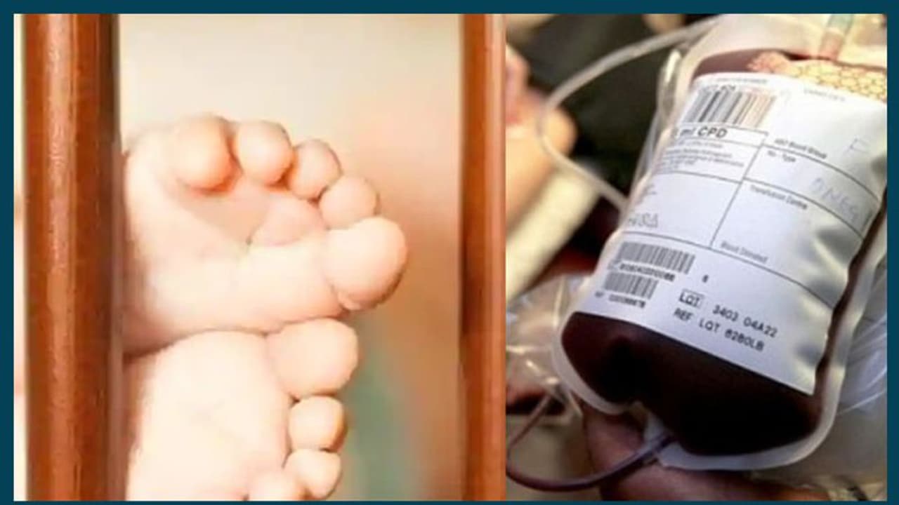 Tamil Nadu pregnant woman given HIV infected blood: Baby tests negative for disease