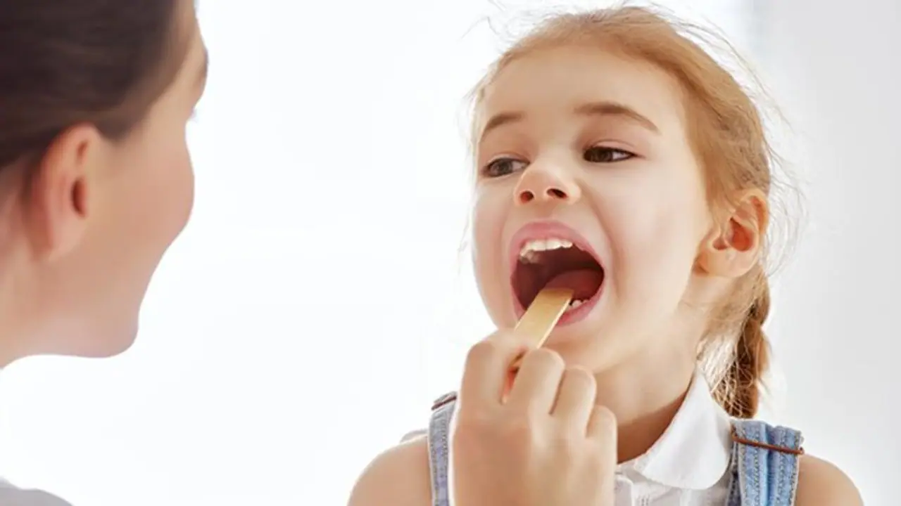 കുട്ടികളിലെ ടോണ്സിലൈറ്റിസ്; എങ്ങനെ തടയാം കുട്ടികളിലെ ടോണ്സിലൈറ്റിസ്; എങ്ങനെ തടയാം