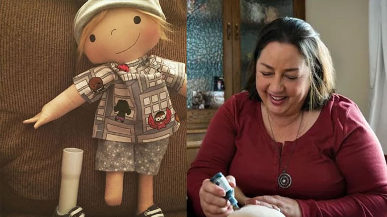 ഒരു കയ്യില്ലാത്ത, കാലില്ലാത്ത, പൊള്ളലേറ്റ പാവകള്; ആമി ഇത്തരം പാവകള് നിര്മ്മിക്കുന്നതിന് കാരണമുണ്ട് ഒരു കയ്യില്ലാത്ത, കാലില്ലാത്ത, പൊള്ളലേറ്റ പാവകള്; ആമി ഇത്തരം പാവകള് നിര്മ്മിക്കുന്നതിന് കാരണമുണ്ട്