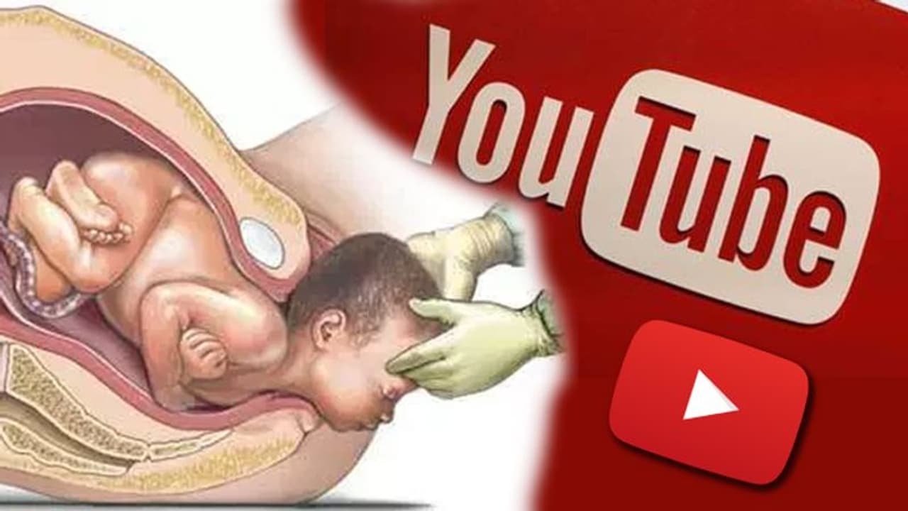 ವಿಡಿಯೋ ನೋಡಿ ಸ್ವಯಂ ಹೆರಿಗೆಗೆ ಯತ್ನಿಸಿದ ಅವಿವಾಹಿತೆ: ತಾಯಿ, ಮಗು ಸಾವು ವಿಡಿಯೋ ನೋಡಿ ಸ್ವಯಂ ಹೆರಿಗೆಗೆ ಯತ್ನಿಸಿದ ಅವಿವಾಹಿತೆ: ತಾಯಿ, ಮಗು ಸಾವು