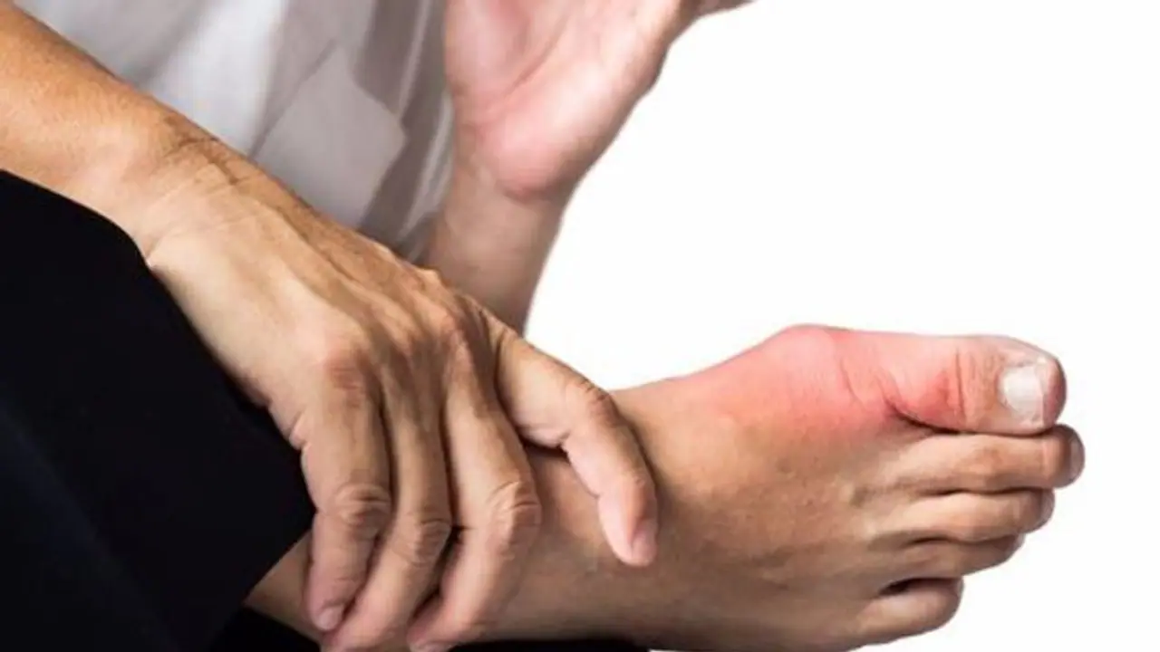 ആർത്രൈറ്റിസ് രോഗങ്ങൾ തടയാൻ സഹായിക്കുന്ന രണ്ട് തരം നട്സുകൾ