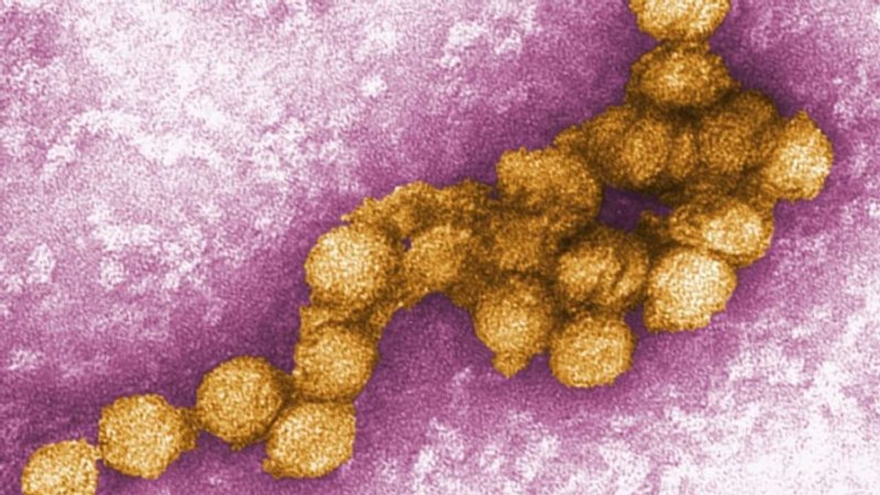 West Nile Virus: വെസ്റ്റ് നൈല് പനി; ലക്ഷണങ്ങൾ ശ്രദ്ധിക്കാതെ പോകരുത്... West Nile Virus: വെസ്റ്റ് നൈല് പനി; ലക്ഷണങ്ങൾ ശ്രദ്ധിക്കാതെ പോകരുത്...