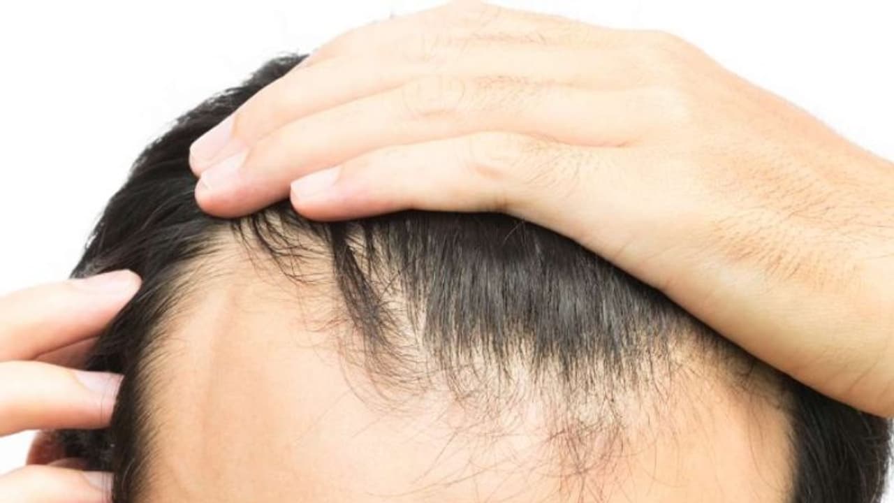 உங்களுக்கு திடீரென முடி கொட்டினால் காரணம்... "இதுவாக கூட" இருக்கலாம்..! உங்களுக்கு திடீரென முடி கொட்டினால் காரணம்... "இதுவாக கூட" இருக்கலாம்..!