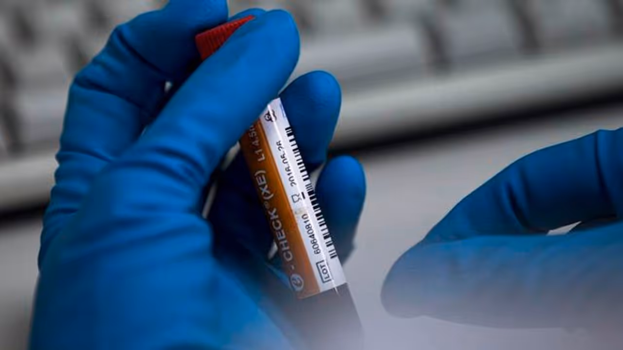 ದುಲೀಪ್ ಟ್ರೋಫಿ ವೇಳೆ ಕ್ರಿಕೆಟಿಗರಿಗೆ ಡೋಪಿಂಗ್ ಟೆಸ್ಟ್ ದುಲೀಪ್ ಟ್ರೋಫಿ ವೇಳೆ ಕ್ರಿಕೆಟಿಗರಿಗೆ ಡೋಪಿಂಗ್ ಟೆಸ್ಟ್