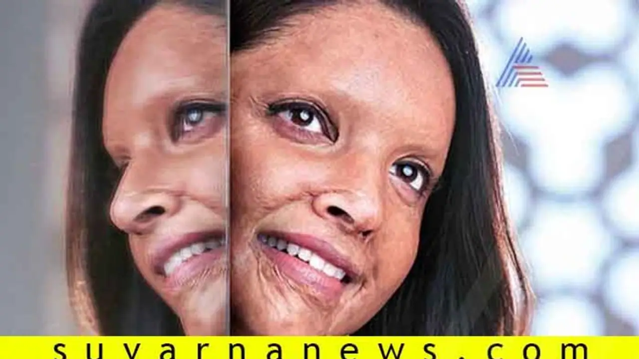 ಮಾತೇ ಬರದಂತೆ ತಡೆಯುತ್ತದೆ 'ಚಪಕ್' ಟ್ರೇಲರ್; ದೀಪಿಕಾ ಸಿಂಪ್ಲಿ ಸೂಪರ್!