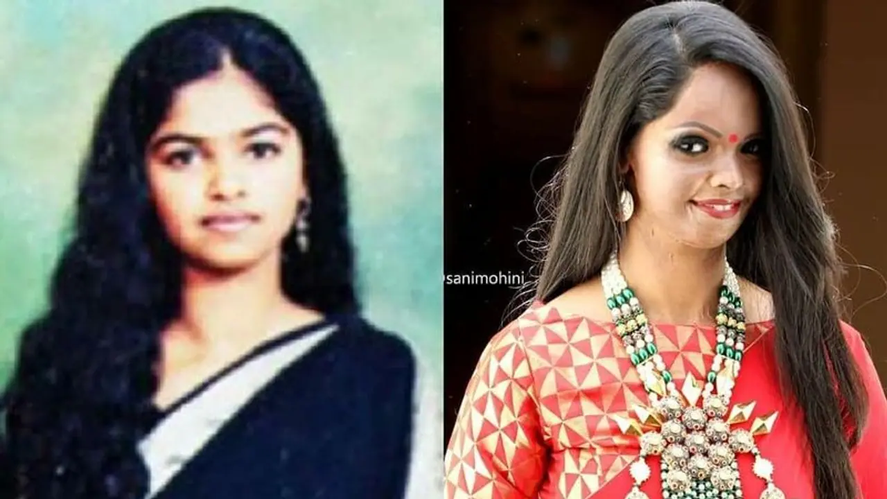 'ആസിഡ് ആക്രമണത്തിനിരയായ പെണ്കുട്ടിയോട് ഈ ചോദ്യം മാത്രം ചോദിക്കരുത്': ലക്ഷ്മി അഗര്വാള് 'ആസിഡ് ആക്രമണത്തിനിരയായ പെണ്കുട്ടിയോട് ഈ ചോദ്യം മാത്രം ചോദിക്കരുത്': ലക്ഷ്മി അഗര്വാള്