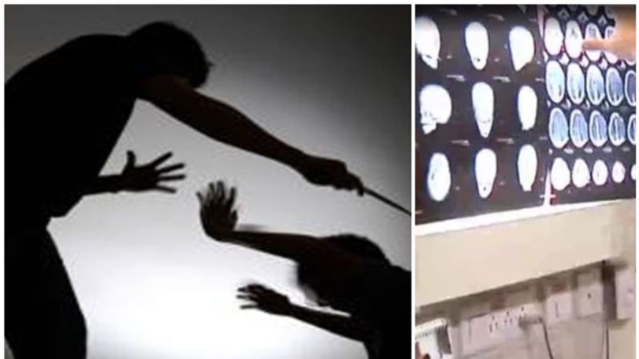 തൊടുപുഴയിൽ കുട്ടിയെ ക്രൂരമായി മർദ്ദിച്ച അരുൺ ആനന്ദ് കൊലക്കേസിൽ ഉൾപ്പടെ പ്രതി തൊടുപുഴയിൽ കുട്ടിയെ ക്രൂരമായി മർദ്ദിച്ച അരുൺ ആനന്ദ് കൊലക്കേസിൽ ഉൾപ്പടെ പ്രതി