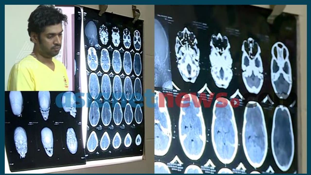 തൊടുപുഴയിലെ ക്രൂര മര്‍ദ്ദനം; കുട്ടിക്ക് മസ്തിഷ്ക മരണം സംഭവിച്ചെന്ന് ഡോക്ടര്‍മാര്‍