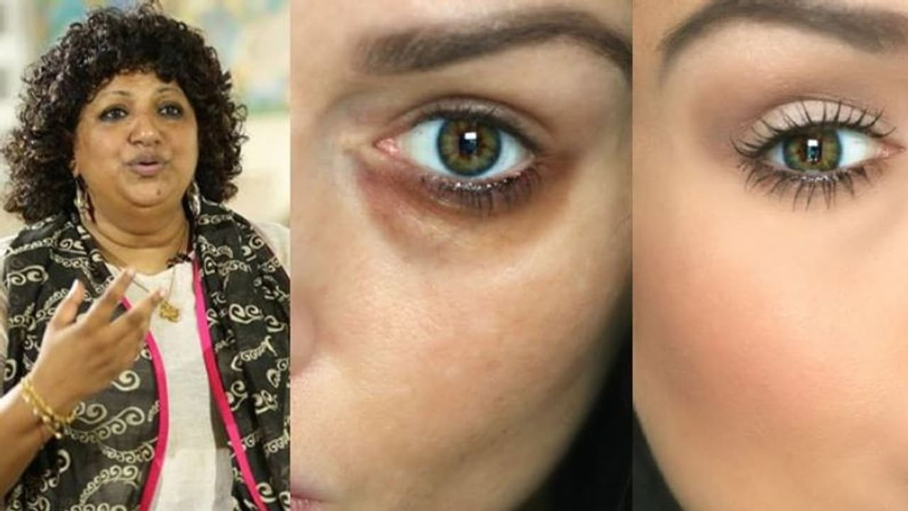 കണ്ണിന് ചുറ്റും കറുപ്പ് നിറമുണ്ടോ? പരിഹാരം അംബികാപിളള പറയും... കണ്ണിന് ചുറ്റും കറുപ്പ് നിറമുണ്ടോ? പരിഹാരം അംബികാപിളള പറയും...