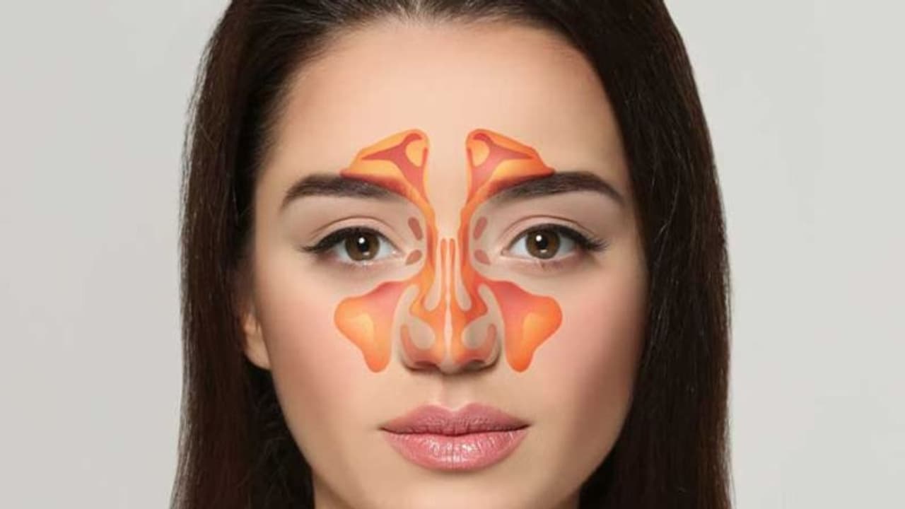 സൈനസൈറ്റിസിനെക്കുറിച്ച് അറിയേണ്ട കാര്യങ്ങള്... സൈനസൈറ്റിസിനെക്കുറിച്ച് അറിയേണ്ട കാര്യങ്ങള്...