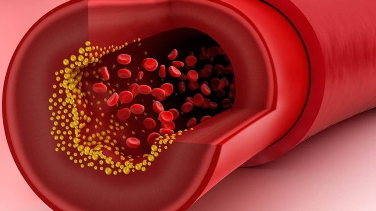 കൊളസ്ട്രോള് എപ്പോള് പരിശോധിക്കണം? കൊളസ്ട്രോള് എപ്പോള് പരിശോധിക്കണം?