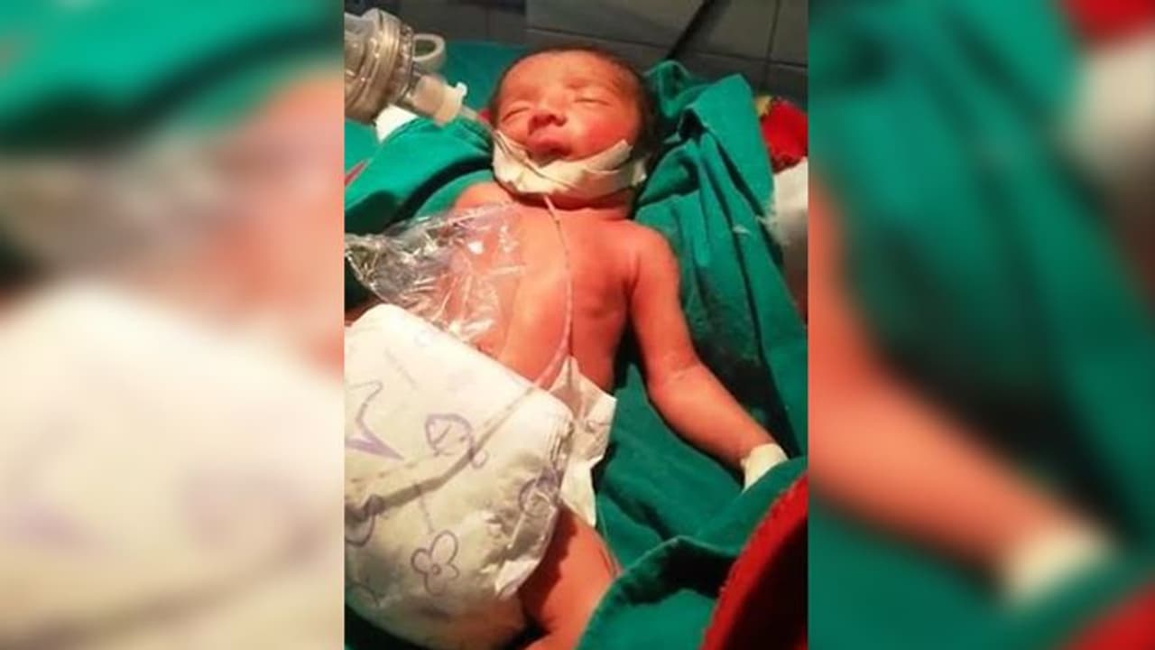 Father died saving the nation, infant battles disease tooth and nail