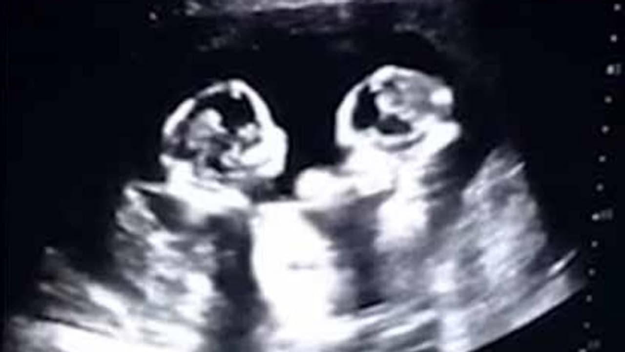 தாயின் வயிற்றில் சண்டையிடும் செர்ரி மற்றும் ஸ்ட்ராபெர்ரி..!காணக்கிடைக்காத வீடியோ..!