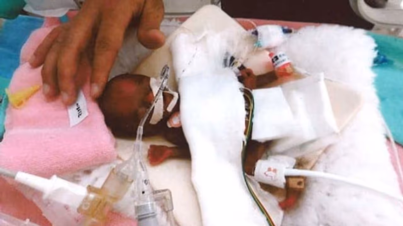 ഒരു ആപ്പിളിനോളം മാത്രം കനമുള്ള കുഞ്ഞ്! ഒരു ആപ്പിളിനോളം മാത്രം കനമുള്ള കുഞ്ഞ്!