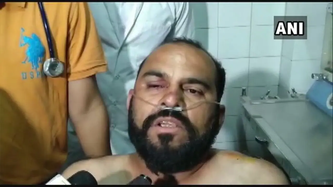 Congress henchmen pack Hardik Patel's attacker off to hospital