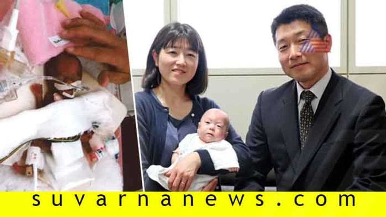 ಸೇಬು ಹಣ್ಣಿನಷ್ಟು ತೂಕವಿದ್ದ ಶಿಶು ಈಗ ಆರೋಗ್ಯಪೂರ್ಣ ಸೇಬು ಹಣ್ಣಿನಷ್ಟು ತೂಕವಿದ್ದ ಶಿಶು ಈಗ ಆರೋಗ್ಯಪೂರ್ಣ