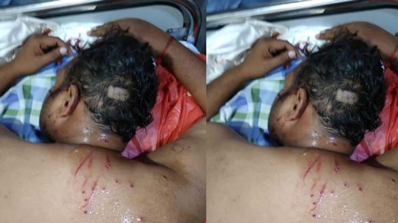 హైదరాబాద్ బీజేపీ ఉపాధ్యక్షుడిపై హత్యాయత్నం హైదరాబాద్ బీజేపీ ఉపాధ్యక్షుడిపై హత్యాయత్నం