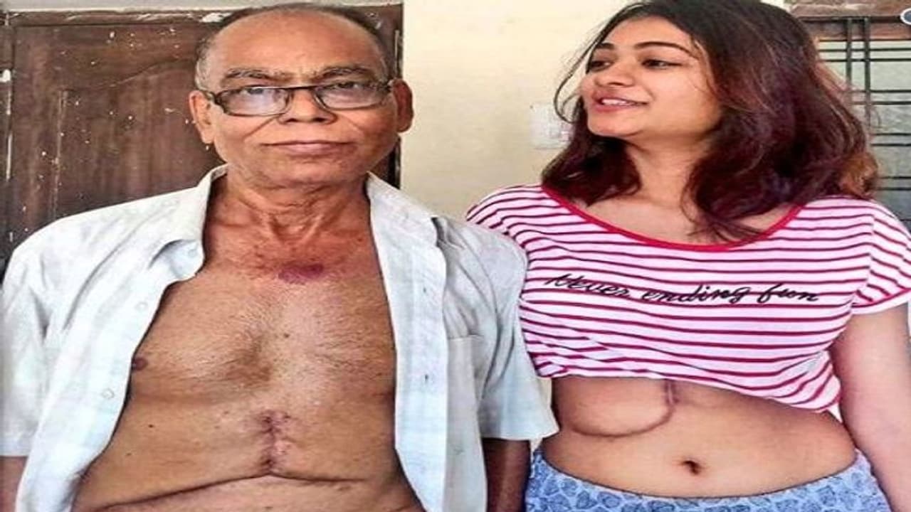 ತಂದೆ ಉಳಿಸಲು ತನ್ನ ಶೇ.65ರಷ್ಟು ಲಿವರ್ ದಾನ ಮಾಡಿದ ಪುತ್ರಿ! ತಂದೆ ಉಳಿಸಲು ತನ್ನ ಶೇ.65ರಷ್ಟು ಲಿವರ್ ದಾನ ಮಾಡಿದ ಪುತ್ರಿ!