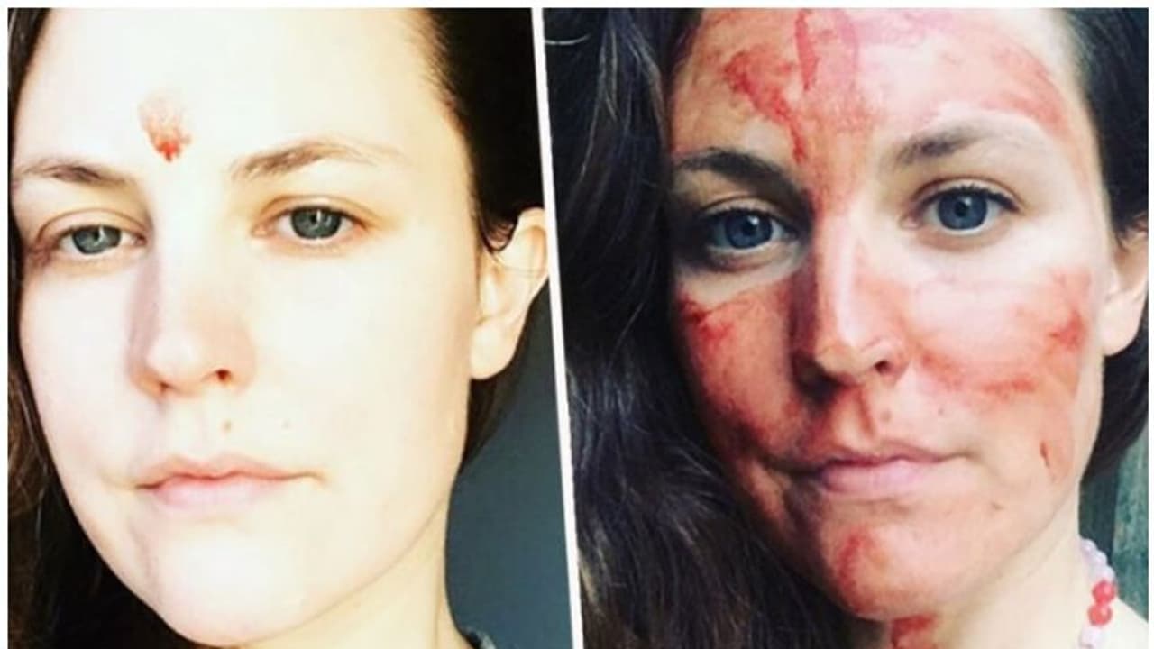 'ഇതിലൂടെ നിങ്ങള് വിശുദ്ധീകരിക്കപ്പെടും'; ആര്ത്തവരക്തം മുഖത്തുപുരട്ടി യുവതി 'ഇതിലൂടെ നിങ്ങള് വിശുദ്ധീകരിക്കപ്പെടും'; ആര്ത്തവരക്തം മുഖത്തുപുരട്ടി യുവതി