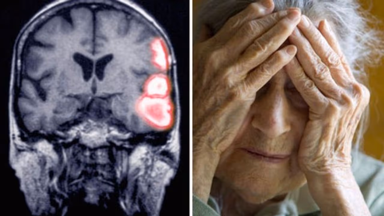 പക്ഷാഘാതവും മറവിരോഗവും പ്രതിരോധിക്കാന്‍ ഇതാ ഒരു മരുന്ന്