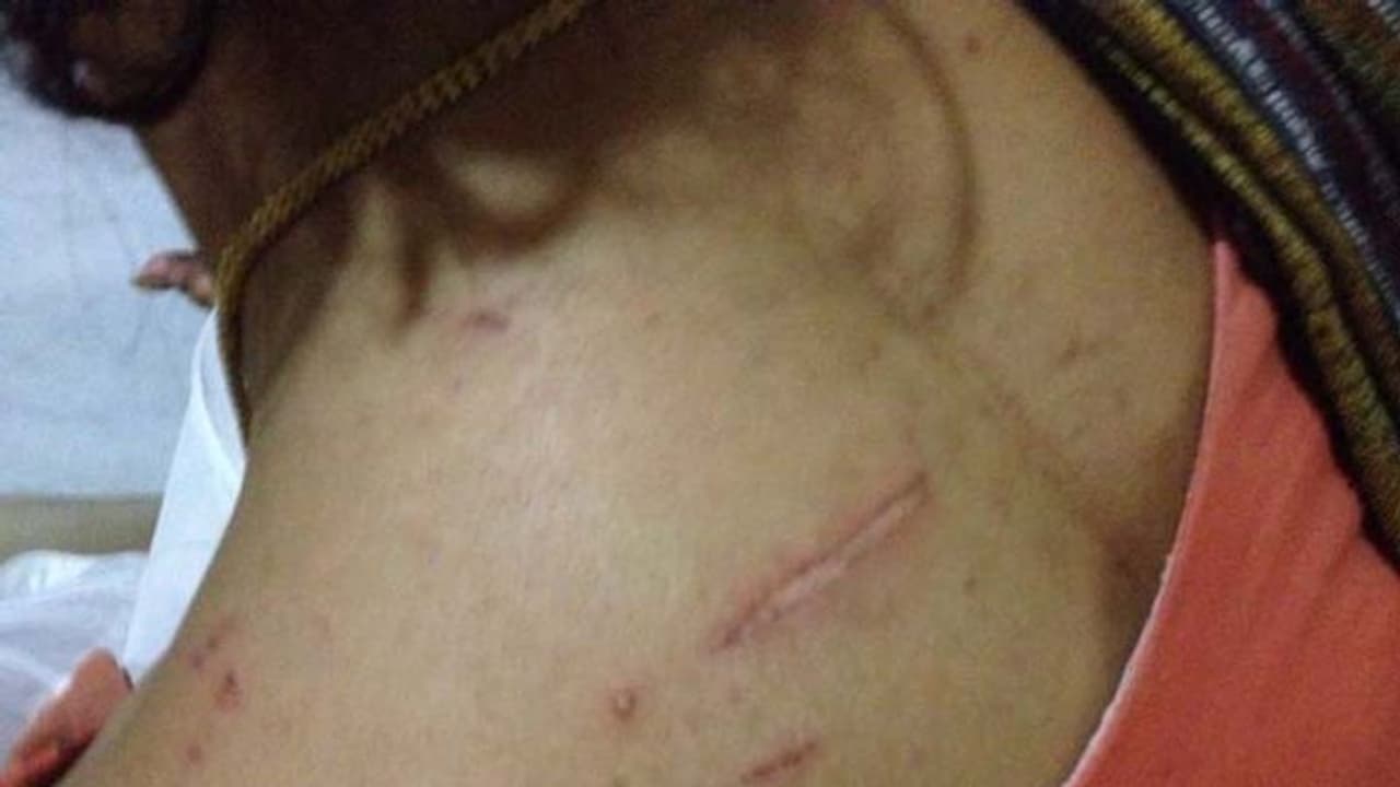 కట్నం కోసం కోడలికి చిత్రహింసలు: జస్టిస్ నూతి రామ్మోహన్‌రావుపై కేసు