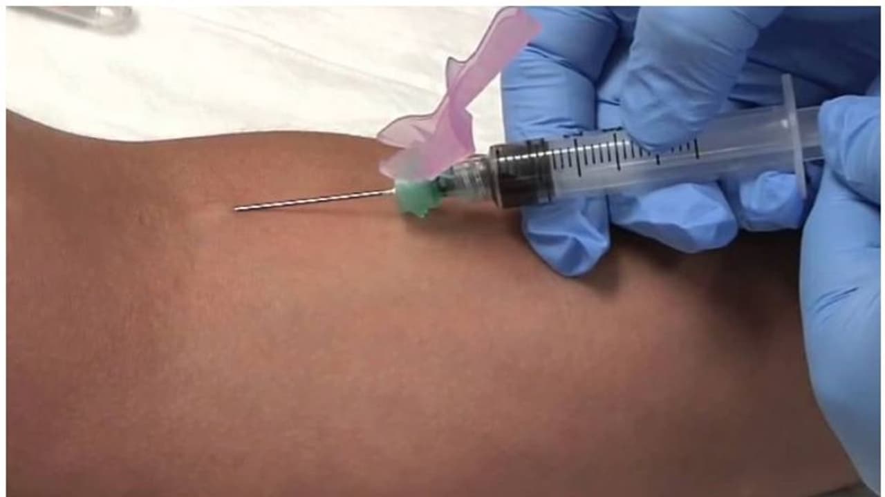 ಒಂದೇ ಸೂಜಿಯಿಂದ ಹಲವು ರೋಗಿಗಳಿಗೆ ಇಂಜೆಕ್ಷನ್, ಎಚ್ಐವಿ ಪಾಸಿಟಿವ್ ಆದ ಬಾಲಕಿ! ಒಂದೇ ಸೂಜಿಯಿಂದ ಹಲವು ರೋಗಿಗಳಿಗೆ ಇಂಜೆಕ್ಷನ್, ಎಚ್ಐವಿ ಪಾಸಿಟಿವ್ ಆದ ಬಾಲಕಿ!