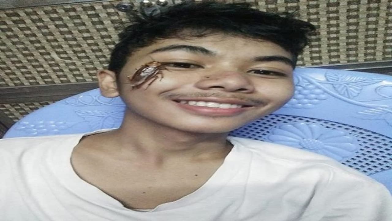 ಹಿಟ್ ಮಾಡಬೇಕಿದ್ದ ಜೀರಳೆಯನ್ನು ಮುಖದ ಮೇಲೆ ಬಿಟ್ಗೊಂಡ್ರು! ಹಿಟ್ ಮಾಡಬೇಕಿದ್ದ ಜೀರಳೆಯನ್ನು ಮುಖದ ಮೇಲೆ ಬಿಟ್ಗೊಂಡ್ರು!