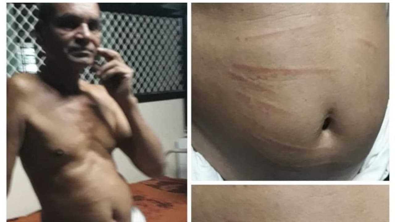 'നാളെ വയറും കാലുമൊക്കെ വെട്ടിക്കീറാന് ഉള്ളതല്ലേ..പിന്നെ ഈ ചെറിയ മുറിവുകള് കാര്യമാക്കണ്ട'; വണ്ടാനം മെഡിക്കല് കോളേജിലെ ജീവനക്കാരന് രോഗികളോട് 'നാളെ വയറും കാലുമൊക്കെ വെട്ടിക്കീറാന് ഉള്ളതല്ലേ..പിന്നെ ഈ ചെറിയ മുറിവുകള് കാര്യമാക്കണ്ട'; വണ്ടാനം മെഡിക്കല് കോളേജിലെ ജീവനക്കാരന് രോഗികളോട്